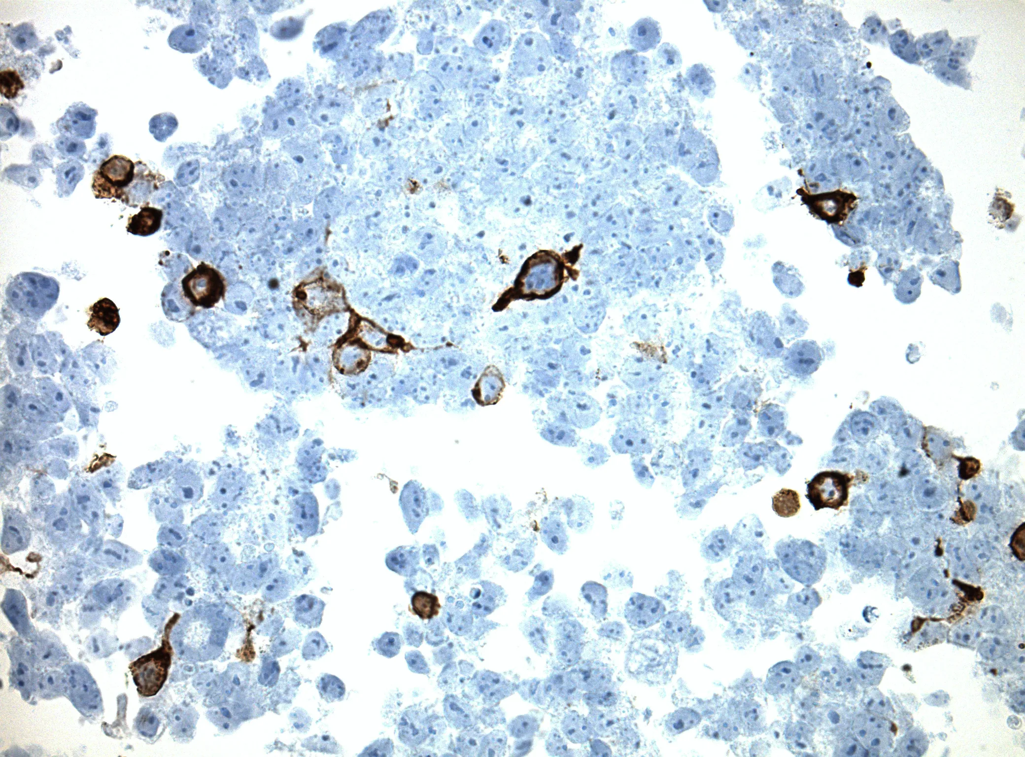Cadherin 8 (CDH8) CytoSection - image 1
