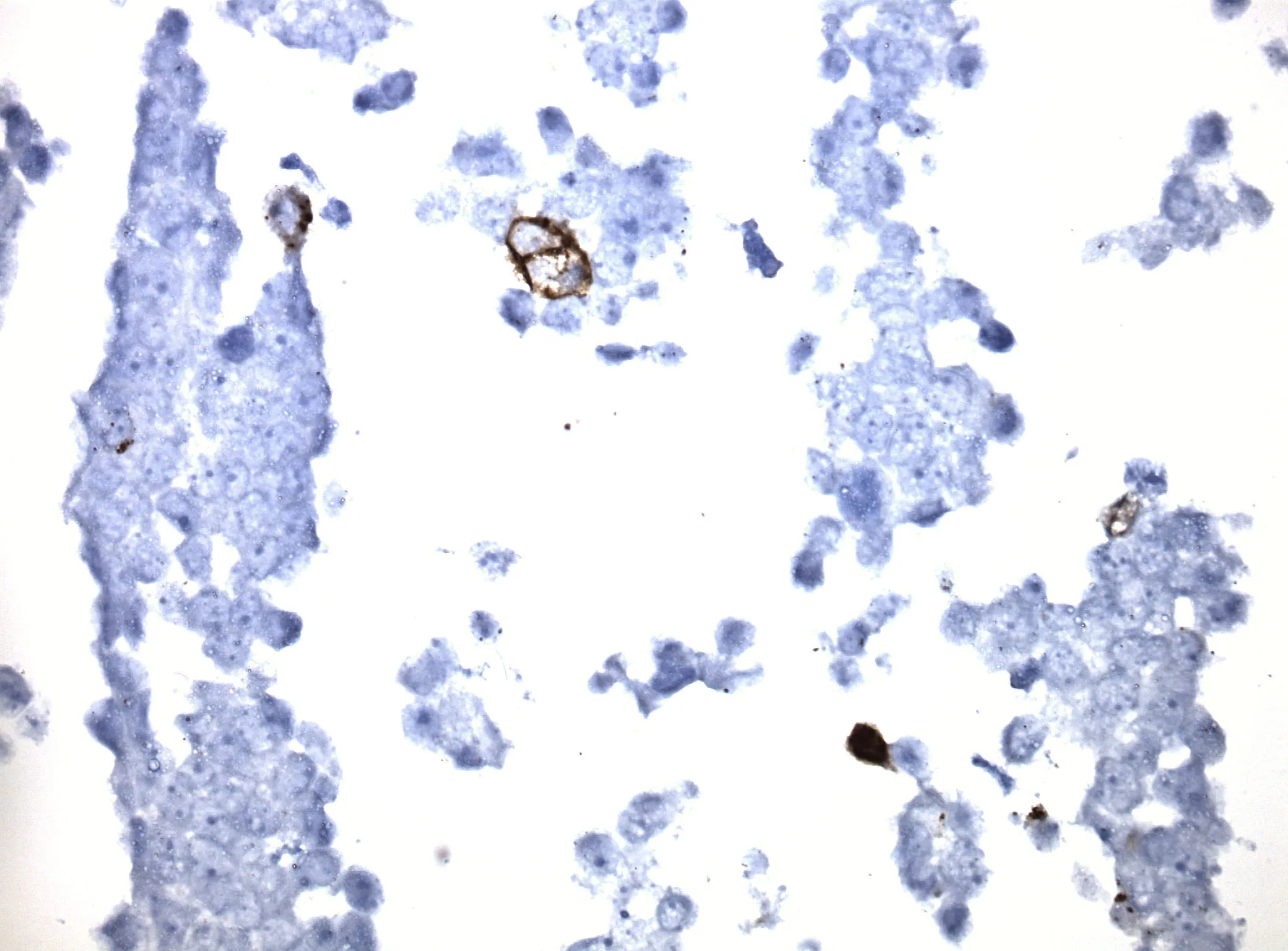 Ribonuclease 3 (RNASE3) CytoSection - image 1