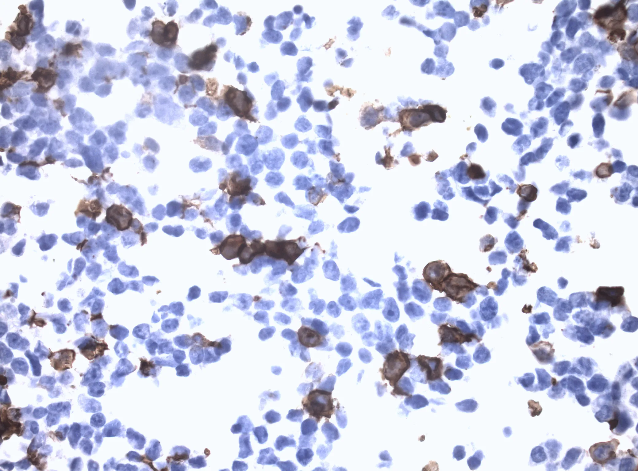 CCR5 CytoSection - image 1