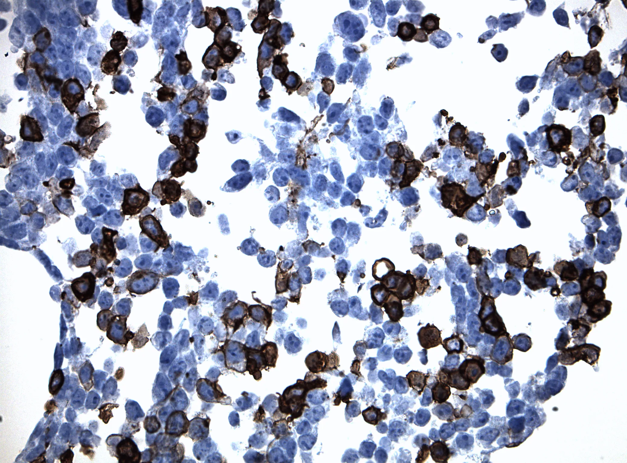 CLEC12A CytoSection - image 1