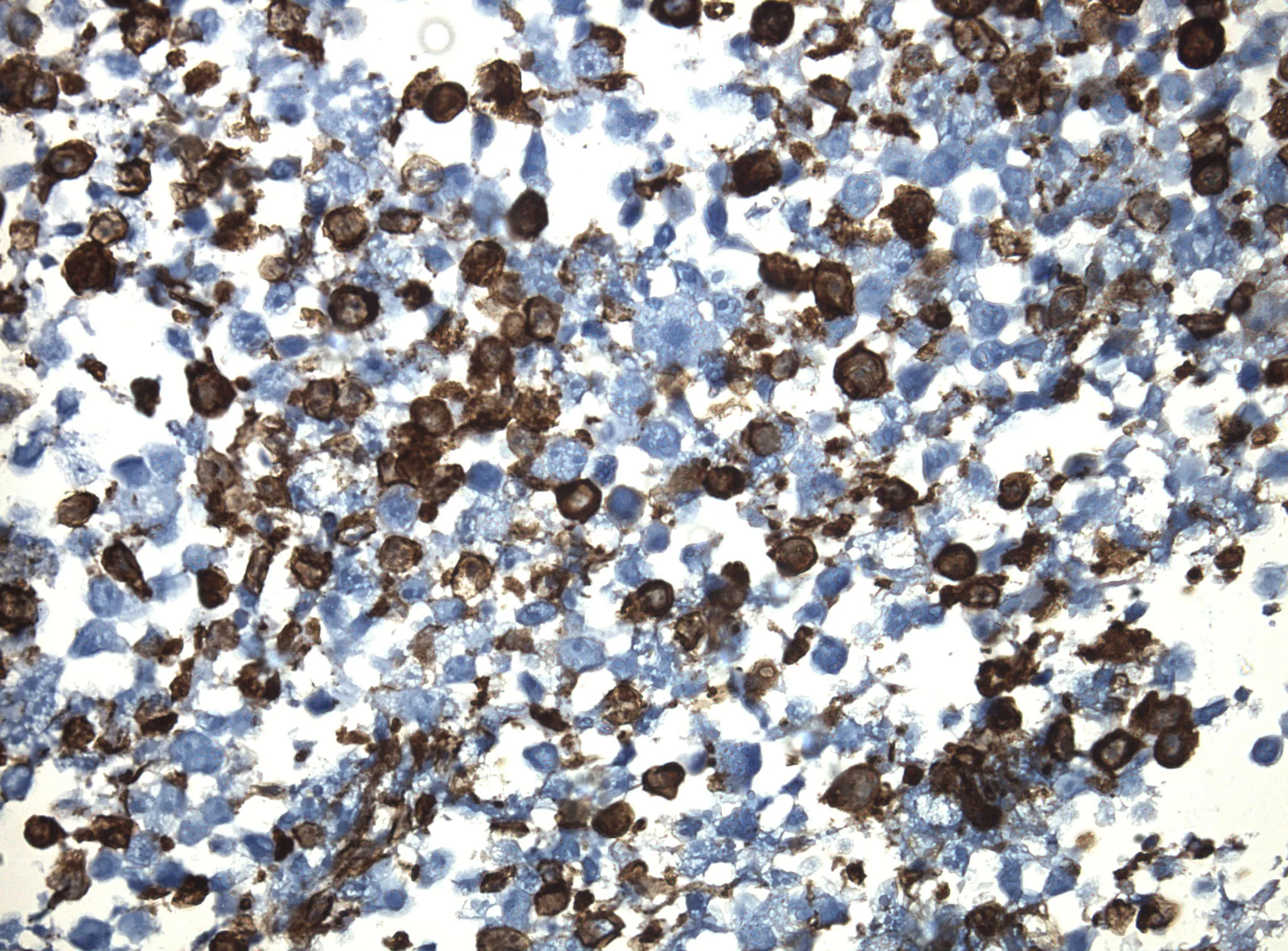 CD8A CytoSection - image 1
