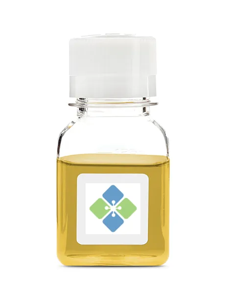 Rheumatoid Factor Positive Plasma - image 1