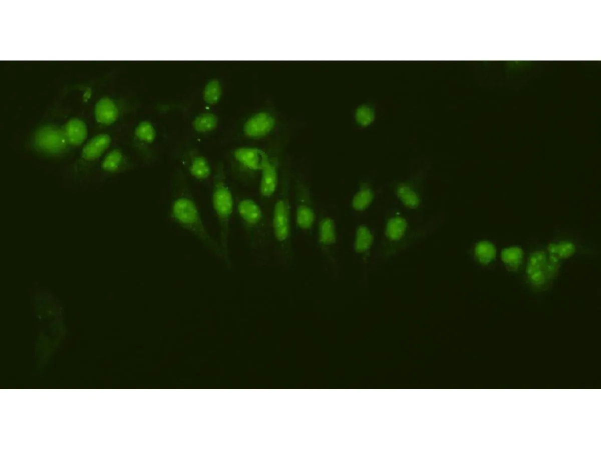 Nucleolin Rabbit Polyclonal Antibody - image 2