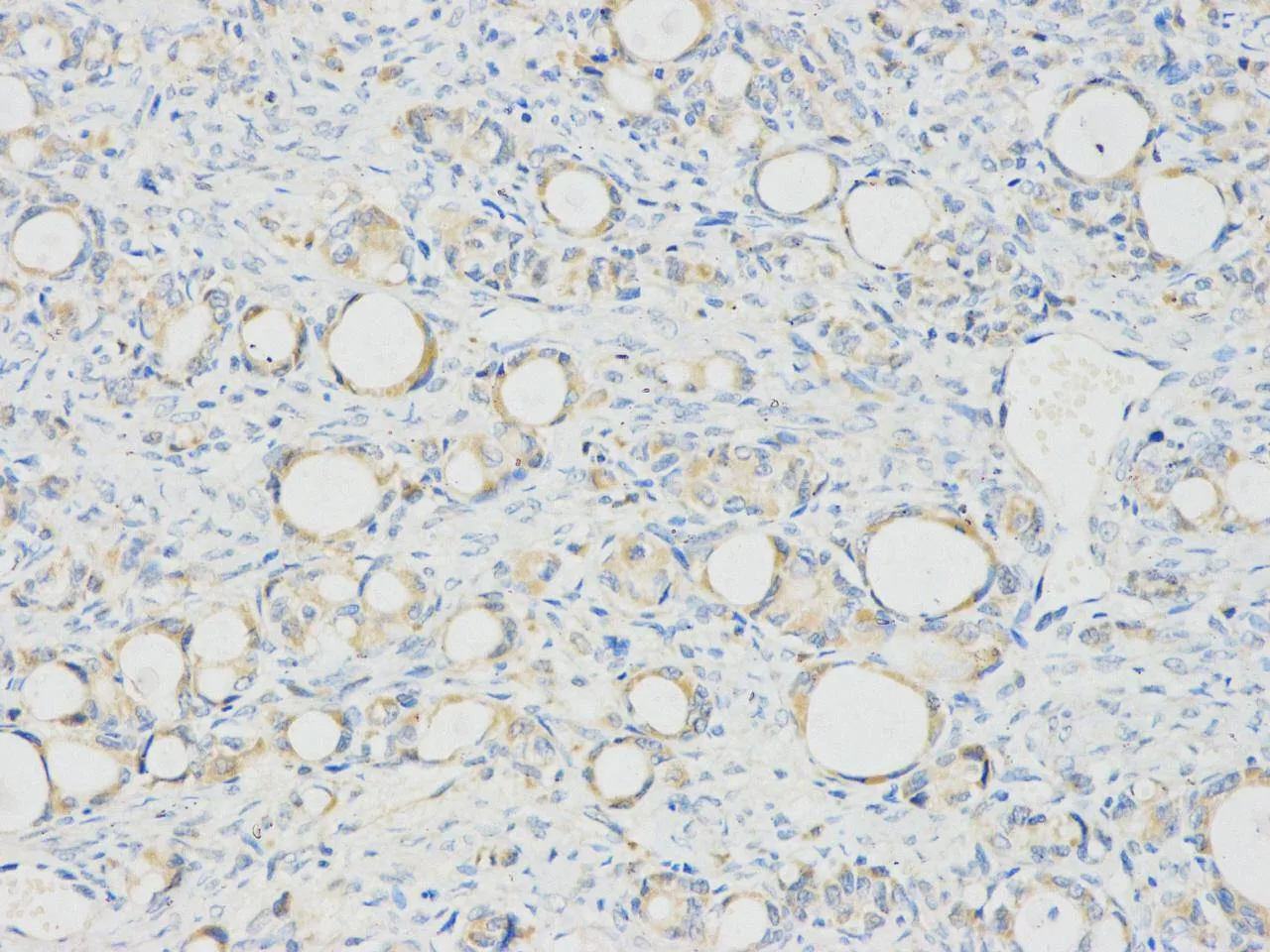 Nucleolin Rabbit Polyclonal Antibody - image 3