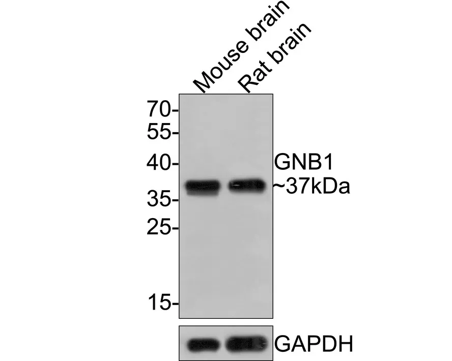 GNB1 Rabbit Polyclonal Antibody - image 1