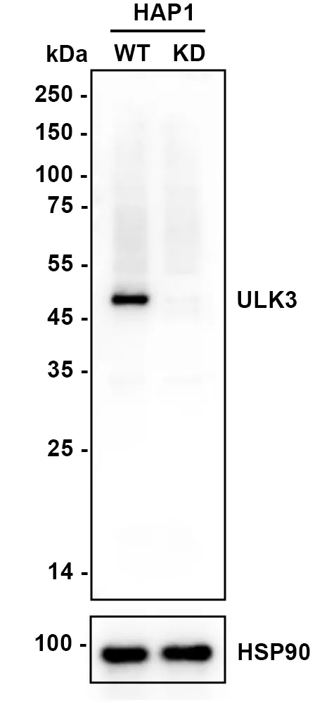 ULK3 Rabbit Polyclonal Antibody - image 1