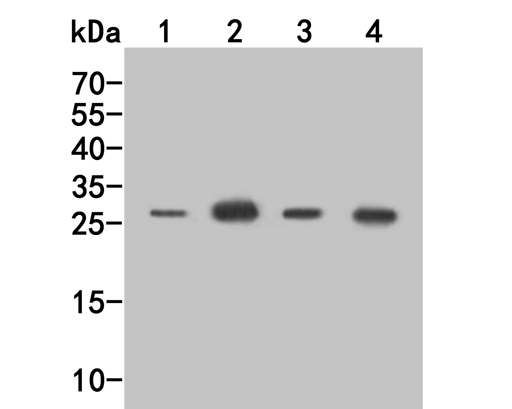CD69 Rabbit Polyclonal Antibody - image 1