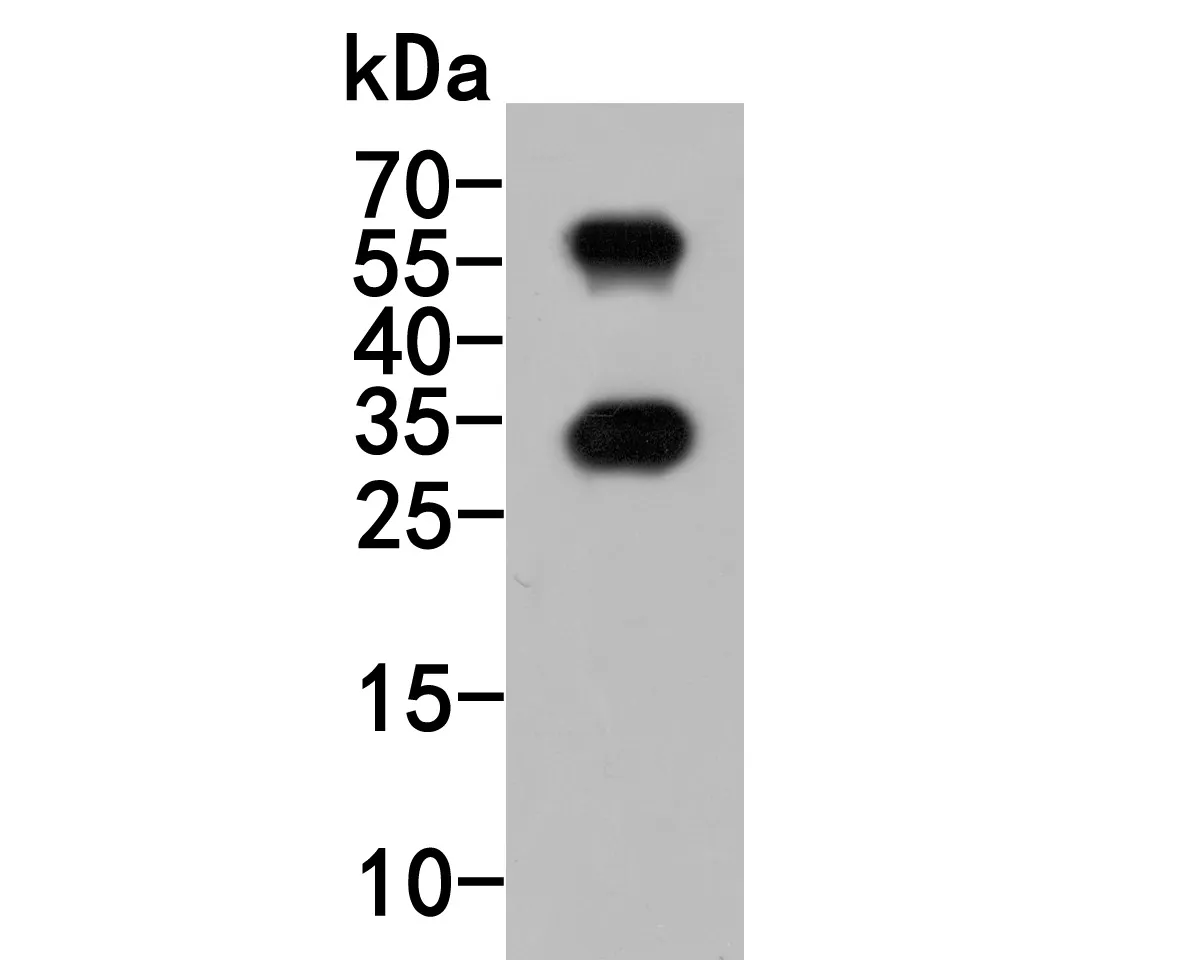 CD69 Rabbit Polyclonal Antibody - image 2