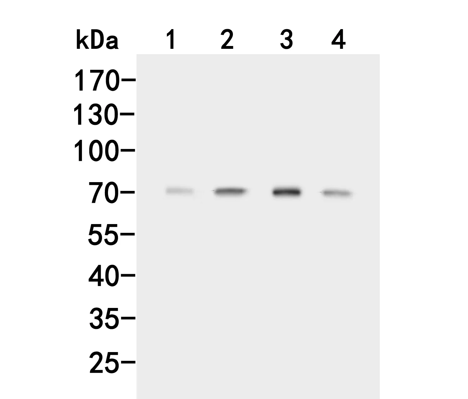 ACVR2A Rabbit Polyclonal Antibody - image 1