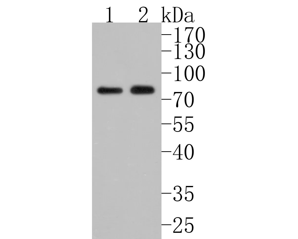ACVR2A Rabbit Polyclonal Antibody - image 2