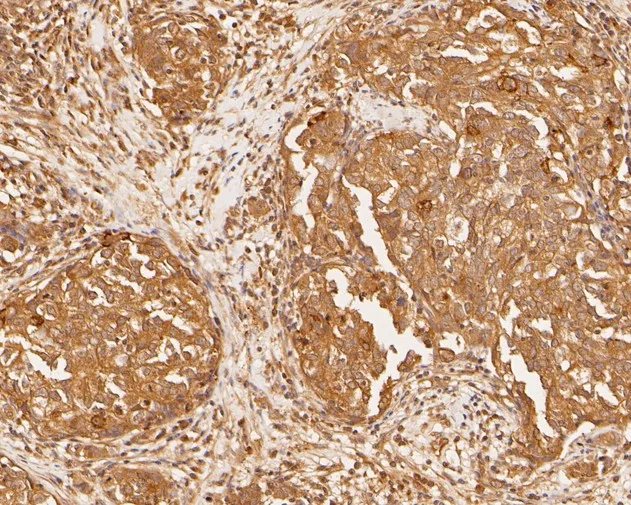 PDCD6 Rabbit Polyclonal Antibody - image 2
