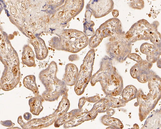 PDCD6 Rabbit Polyclonal Antibody - image 3