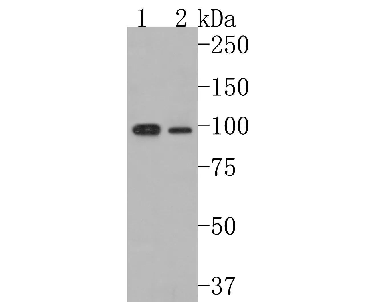 ClC2 Rabbit Polyclonal Antibody - image 1