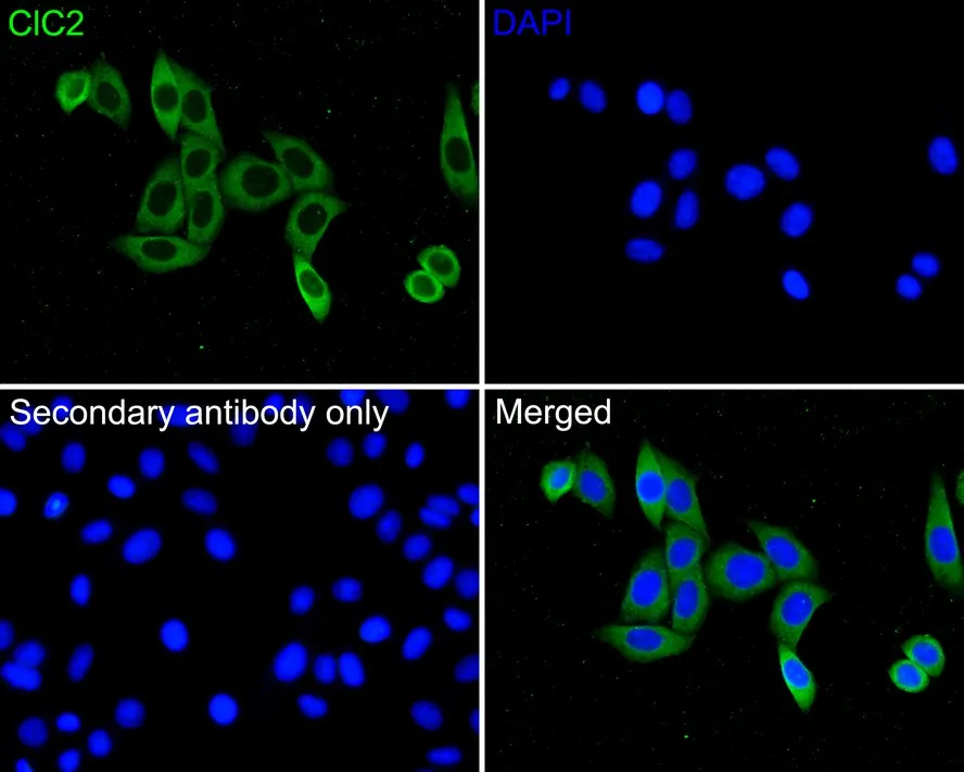 ClC2 Rabbit Polyclonal Antibody - image 2