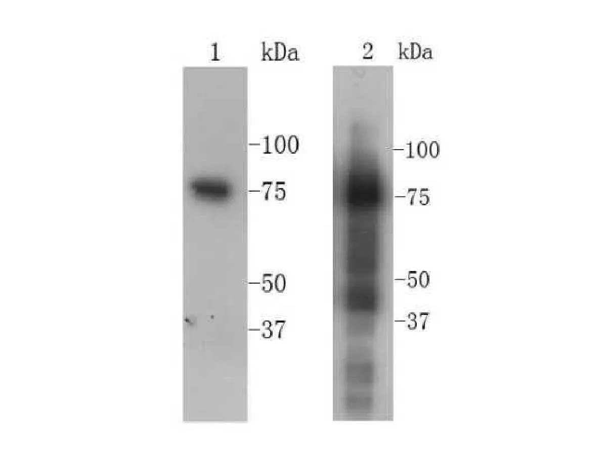 Transferrin Rabbit Polyclonal Antibody - image 1