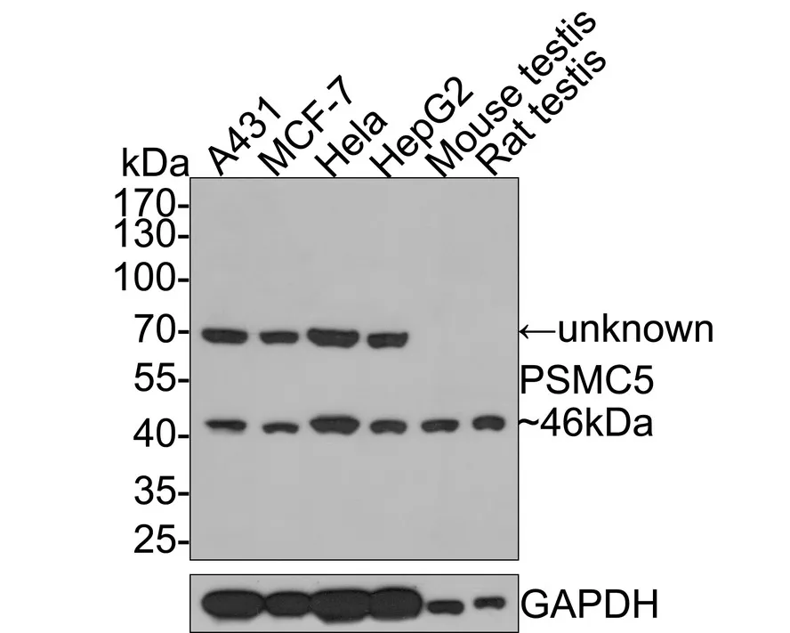 PSMC5 Rabbit Polyclonal Antibody - image 1