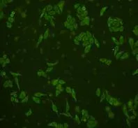 GRB2 Rabbit Polyclonal Antibody - image 2