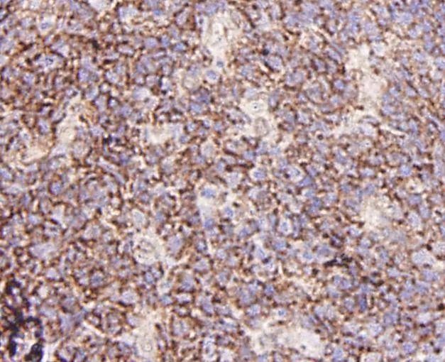 GRB2 Rabbit Polyclonal Antibody - image 3
