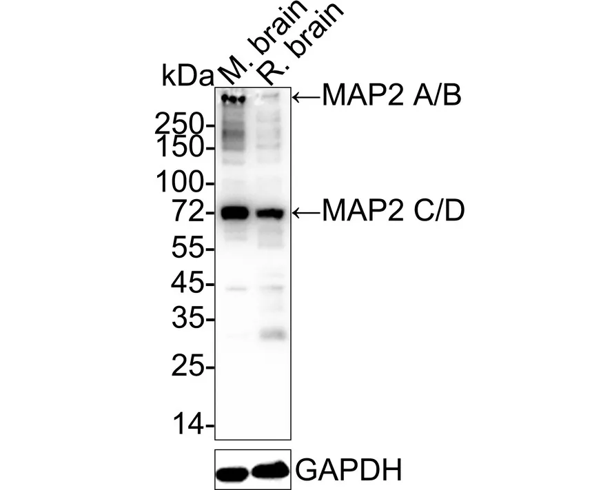 MAP2 Rabbit Polyclonal Antibody - image 1
