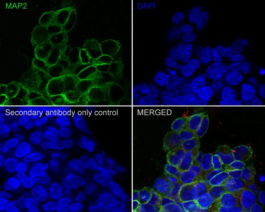 MAP2 Rabbit Polyclonal Antibody - image 2