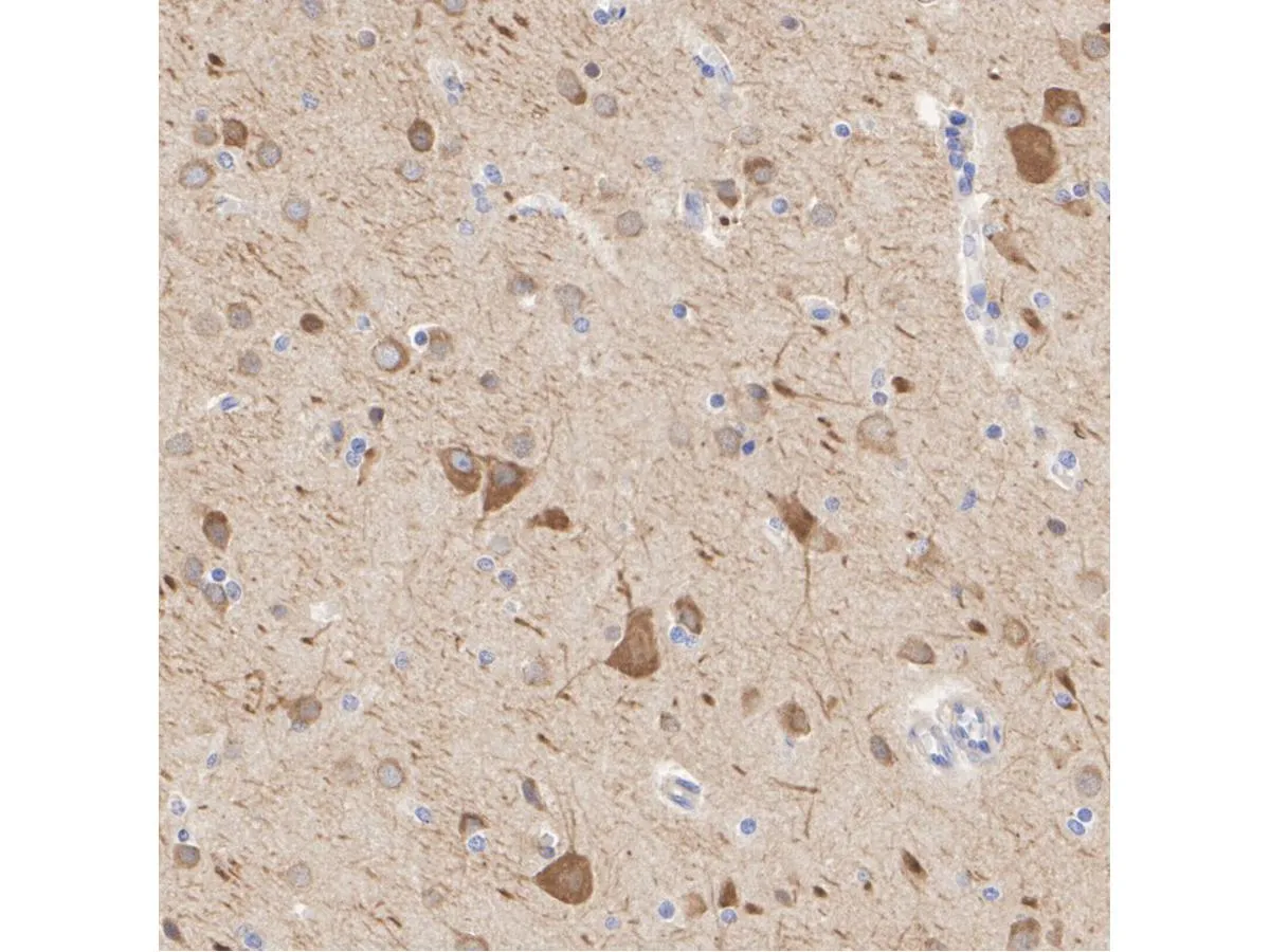 MAP2 Rabbit Polyclonal Antibody - image 3