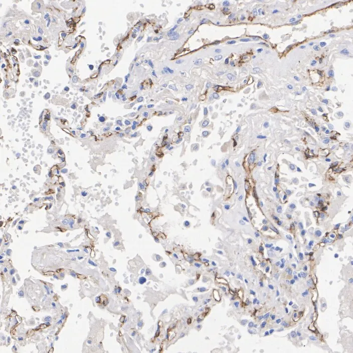 CD31 Rabbit Polyclonal Antibody - image 2