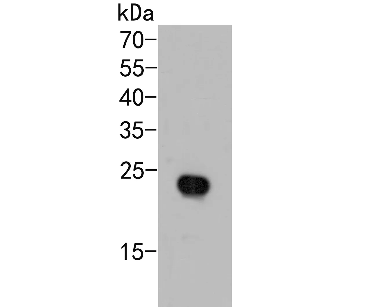 AP repeat Rabbit Polyclonal Antibody - image 1