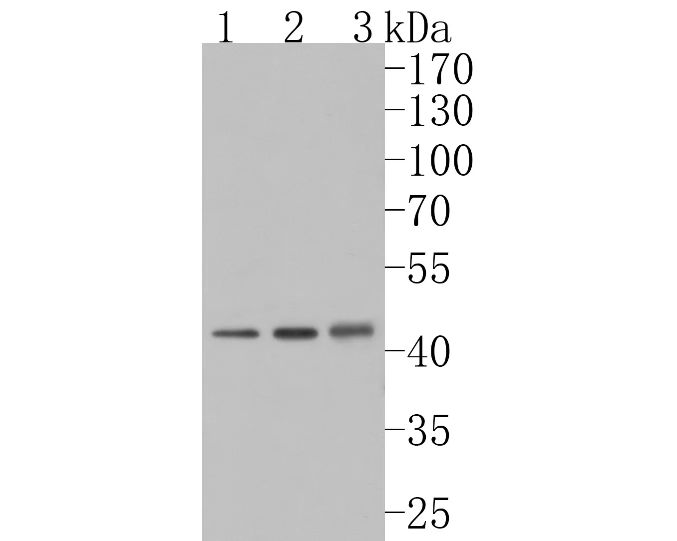 NMBR Rabbit Polyclonal Antibody - image 1