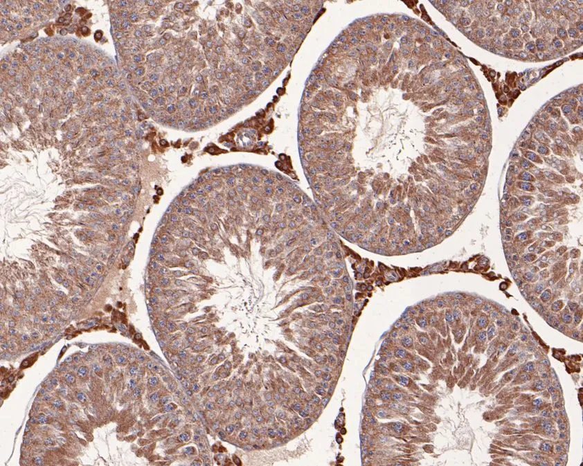 NMBR Rabbit Polyclonal Antibody - image 2