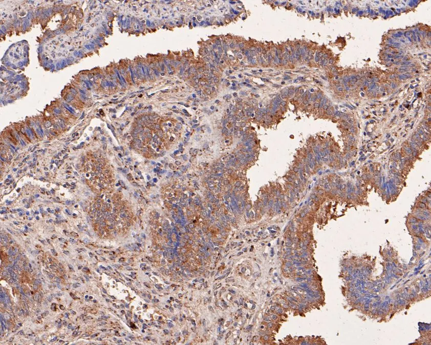 NMBR Rabbit Polyclonal Antibody - image 3