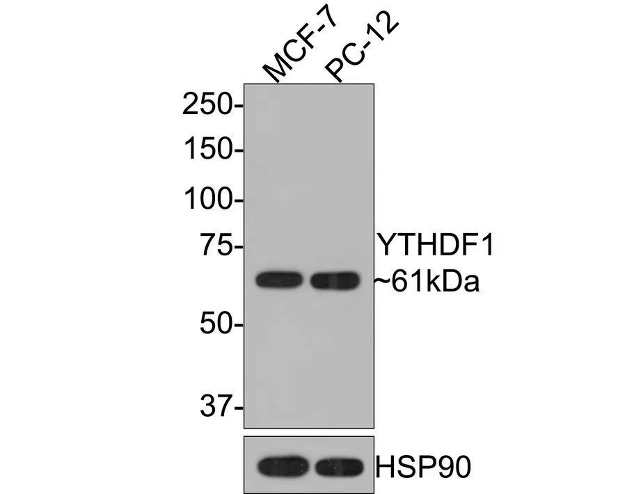 YTHDF1 Rabbit Polyclonal Antibody - image 1