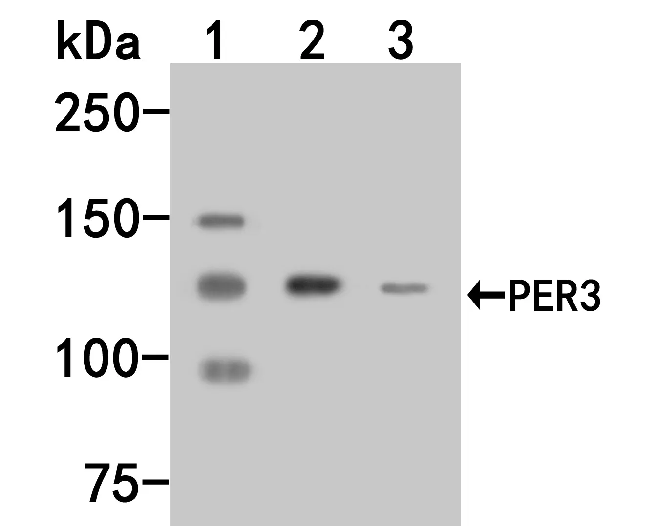 PER3 Rabbit Polyclonal Antibody - image 1