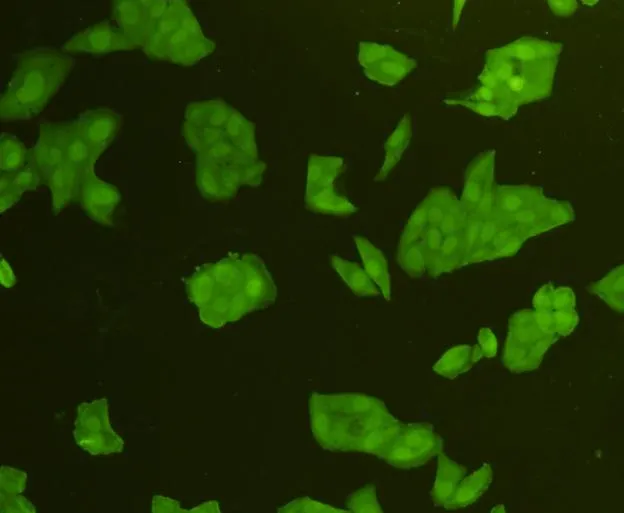 CDK6 Rabbit Polyclonal Antibody - image 3
