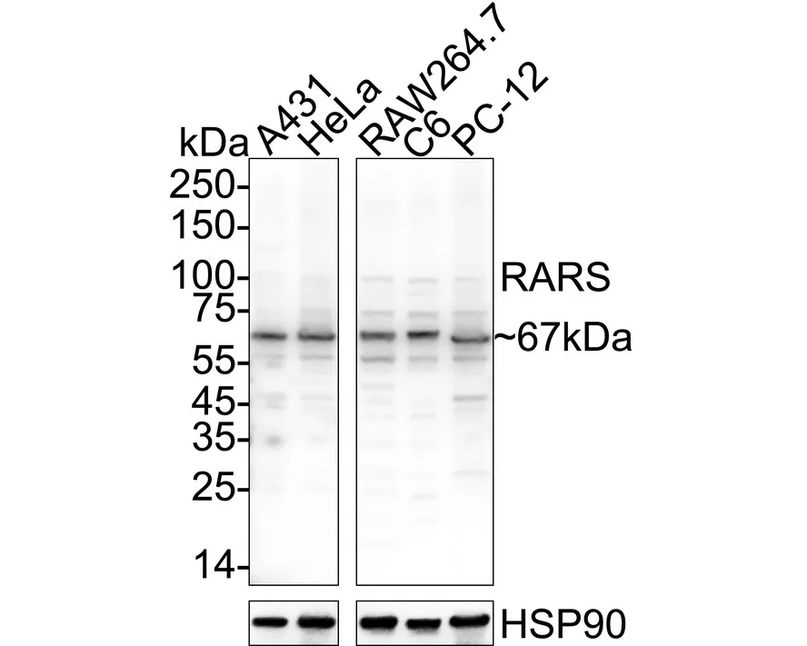 RARS Rabbit Polyclonal Antibody - image 1