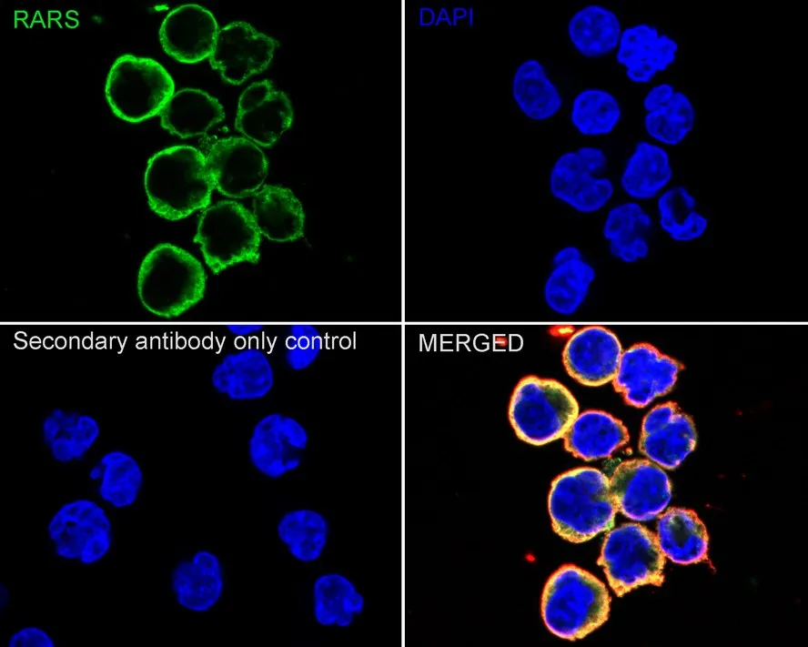 RARS Rabbit Polyclonal Antibody - image 2