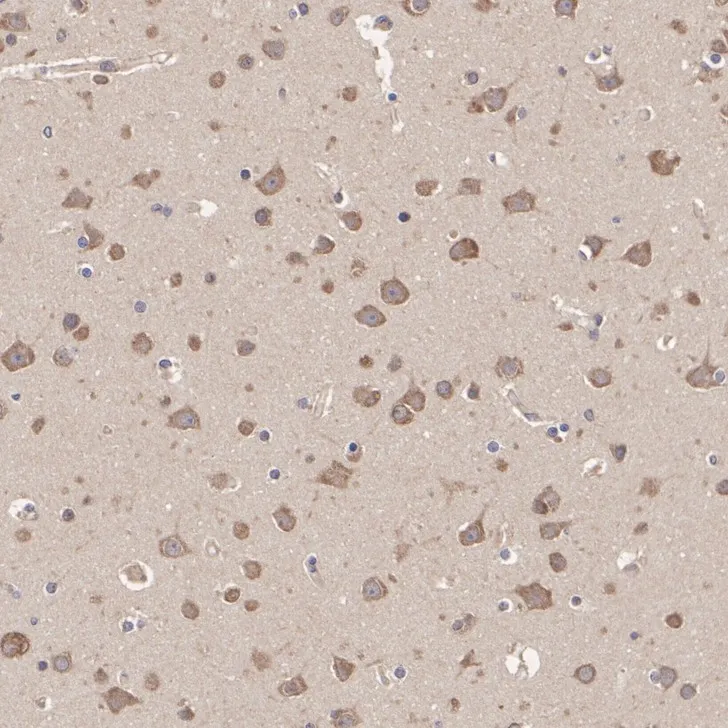 RARS Rabbit Polyclonal Antibody - image 3