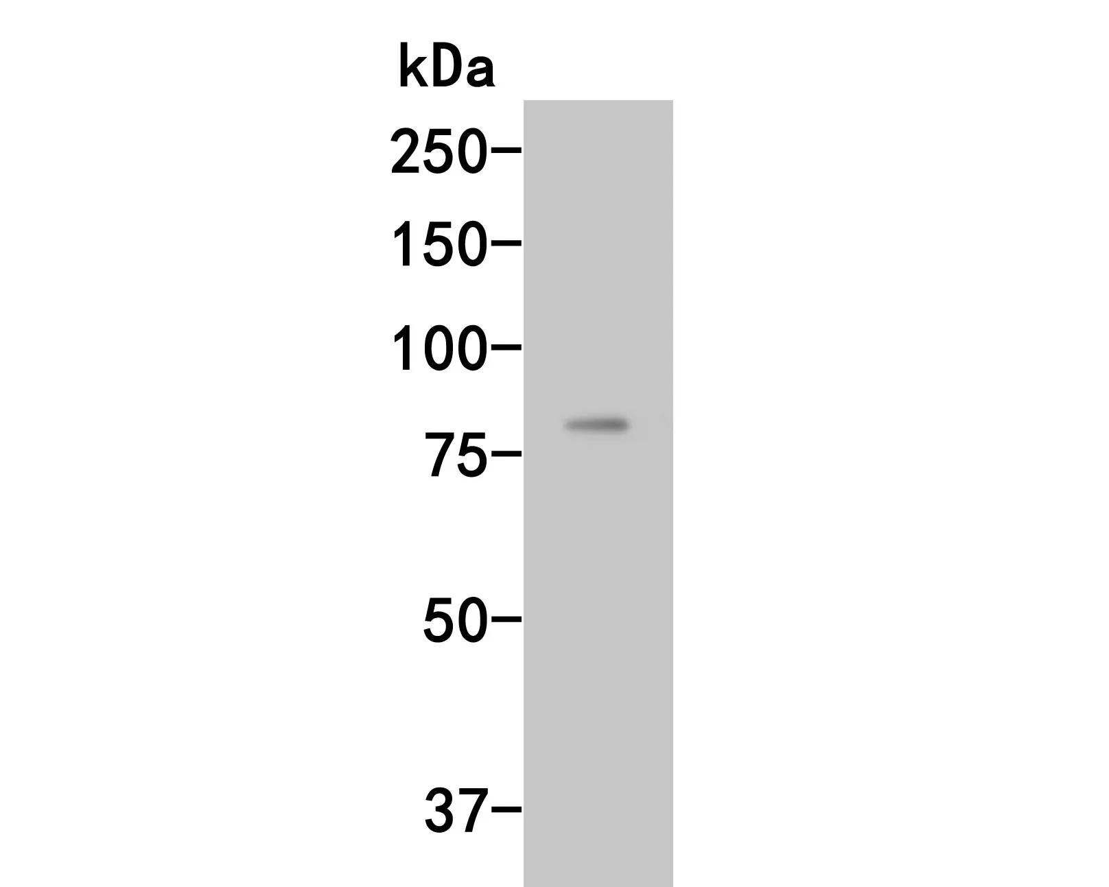 Complement factor B Rabbit Polyclonal Antibody - image 1