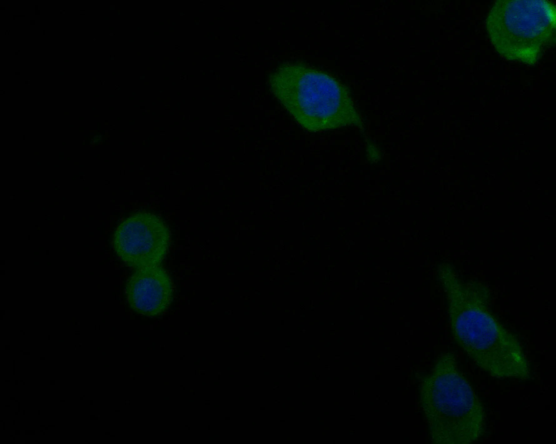 Complement factor B Rabbit Polyclonal Antibody - image 2