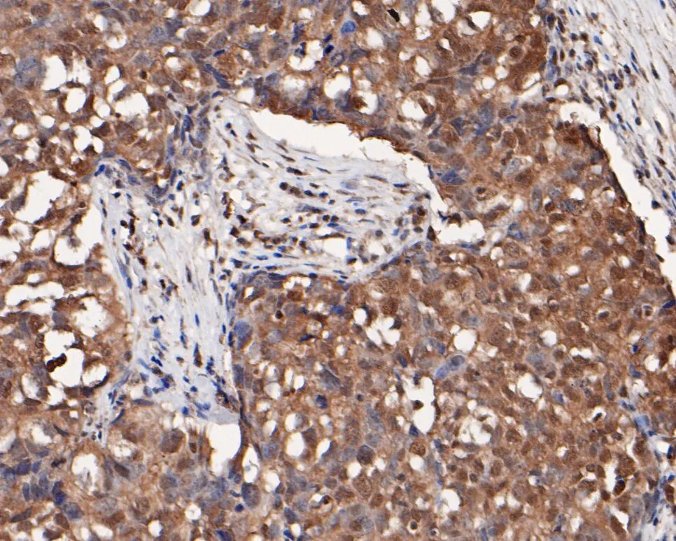 mTOR Rabbit Polyclonal Antibody - image 3