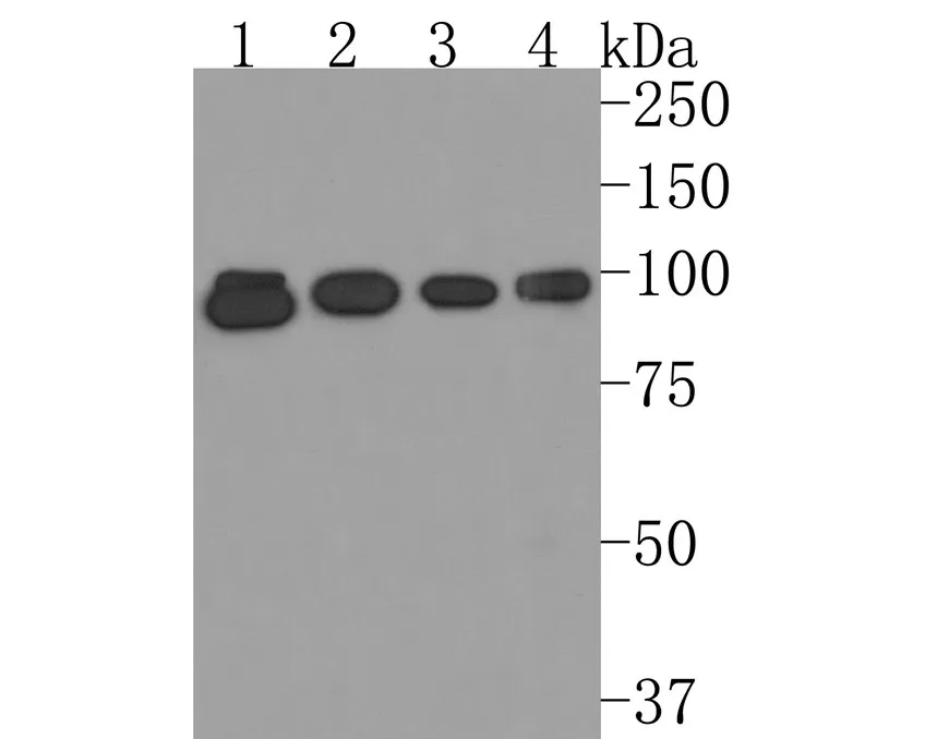 PDE6 alpha Rabbit Polyclonal Antibody - image 1