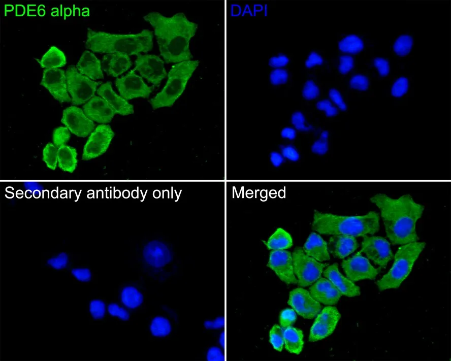 PDE6 alpha Rabbit Polyclonal Antibody - image 2
