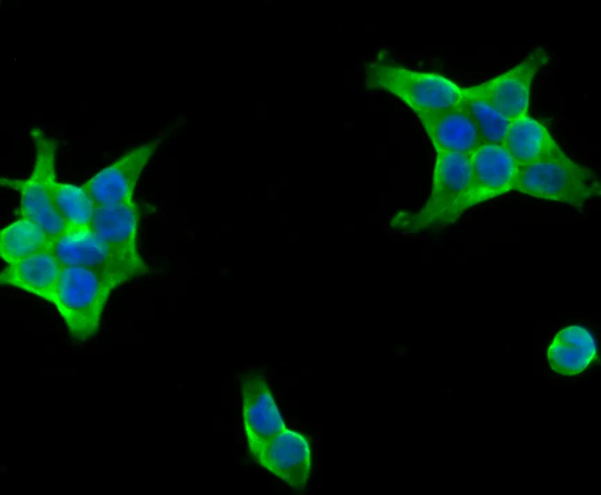 UAP1 Rabbit Polyclonal Antibody - image 2