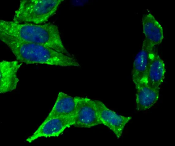 UAP1 Rabbit Polyclonal Antibody - image 3