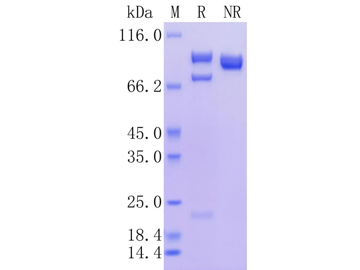 Human Complement Component C5a, C-His Tag - image 1