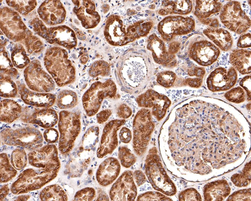 AP2A2 Rabbit Polyclonal Antibody - image 2