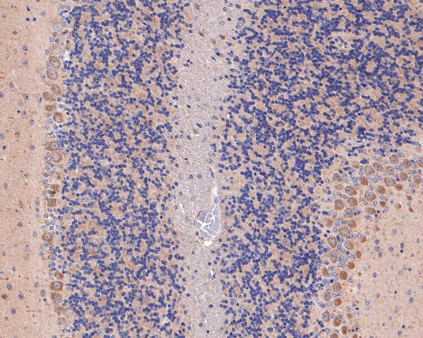 AP2A2 Rabbit Polyclonal Antibody - image 3