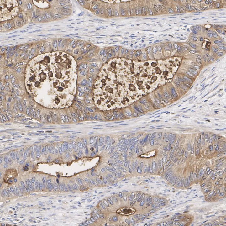 CD66b Rabbit Polyclonal Antibody - image 3