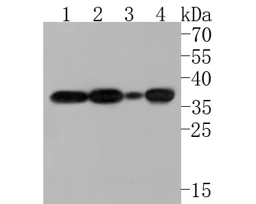 TRAP alpha Rabbit Polyclonal Antibody - image 1