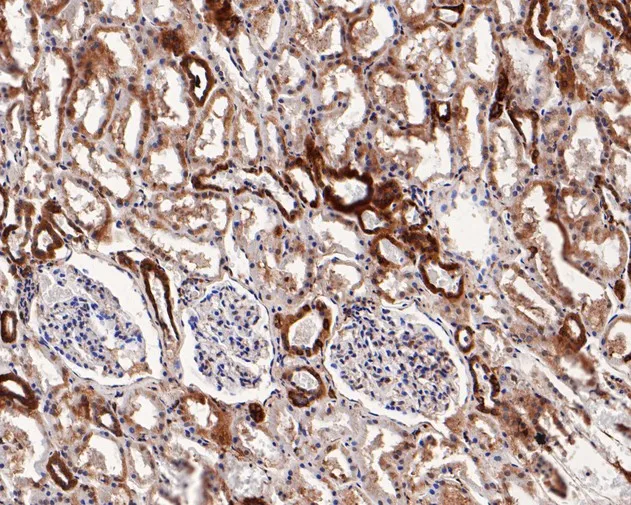 TRAP alpha Rabbit Polyclonal Antibody - image 2