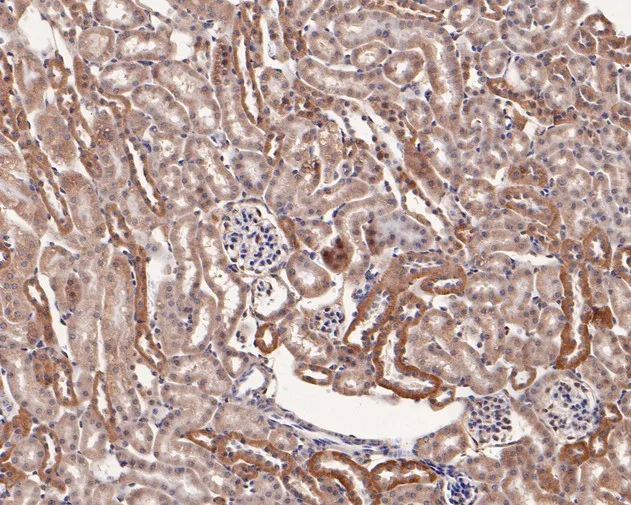 TRAP alpha Rabbit Polyclonal Antibody - image 3